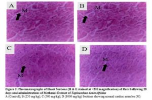 Photomicrographs of Heart Sections (H & E stained at ×250 magnification) of Rats Following 28 days oral administrations of Methanol Extract of Tapinanthus dodoneifolius