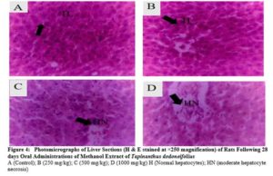 Photomicrographs of Liver Sections (H & E stained at ×250 magnification) of Rats Following 28 days Oral Administrations of Methanol Extract of Tapinanthus dodoneifolius