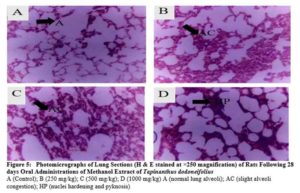 Photomicrographs of Lung Sections (H & E stained at ×250 magnification) of Rats Following 28 days Oral Administrations of Methanol Extract of Tapinanthus dodoneifolius