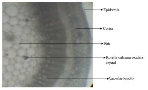 Transverse section of the stem of Diodia sarmentosa (Magnification X64)