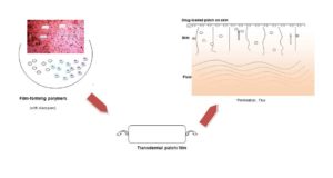 Transdermal drug delivery graphical abstract