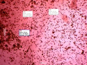 Transdermal drug delivery: Photomicrograph of cassava starch particles 